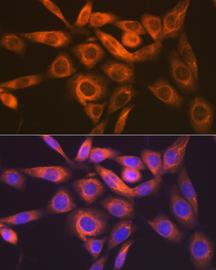[KO Validated] IMPDH2 Rabbit monoclonal antibody