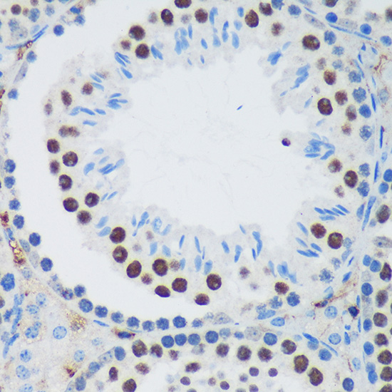 PSPC1 Rabbit polyclonal antibody