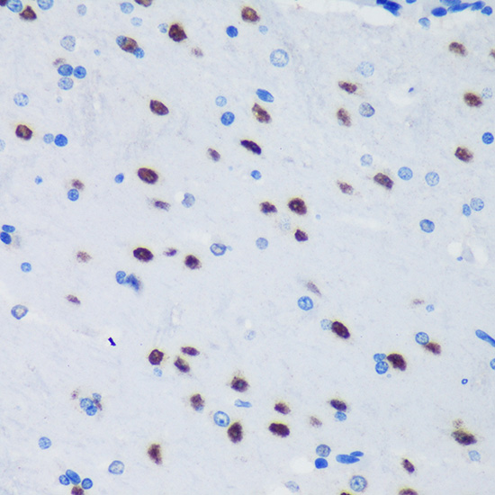 PSPC1 Rabbit polyclonal antibody