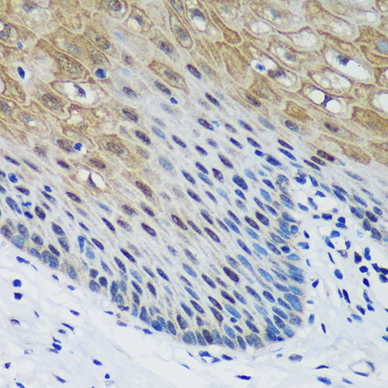 PSPC1 Rabbit polyclonal antibody