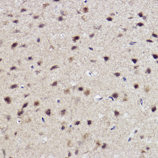 ALKBH1 Rabbit monoclonal antibody