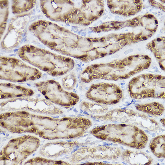 ALKBH1 Rabbit monoclonal antibody