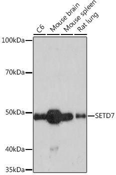SETD7 Rabbit monoclonal antibody