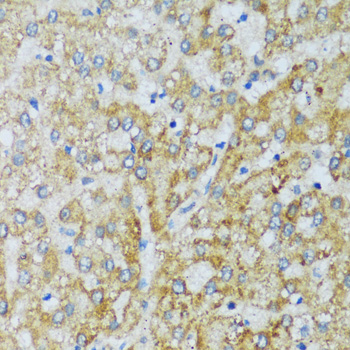C1QC Rabbit polyclonal antibody