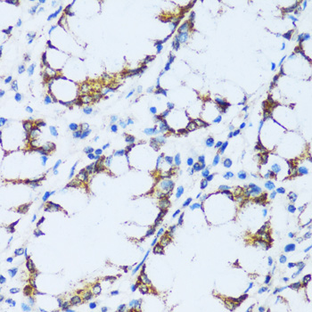 C1QC Rabbit polyclonal antibody