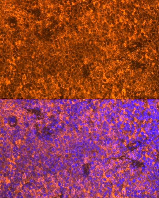 FAM65B Rabbit polyclonal antibody