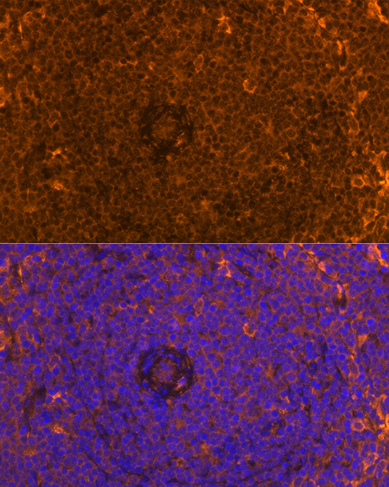 FAM65B Rabbit polyclonal antibody