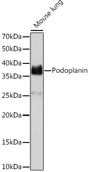 Podoplanin Rabbit monoclonal antibody