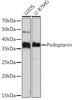 Podoplanin Rabbit monoclonal antibody