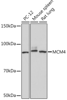 MCM4 Rabbit mAb