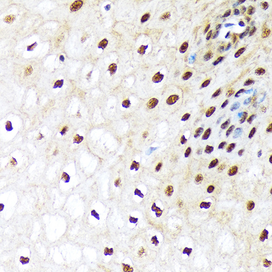 UBA1 Rabbit monoclonal antibody