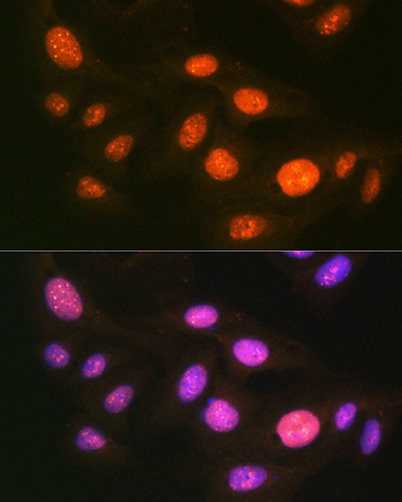 UBA1 Rabbit monoclonal antibody