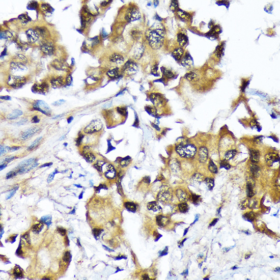 Ube2N/Ubc13 Rabbit monoclonal antibody
