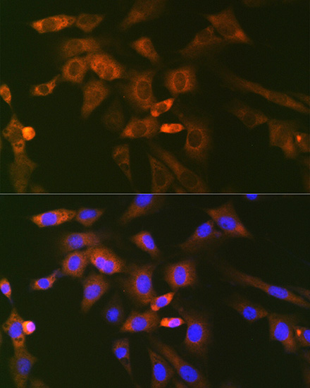 Ube2N/Ubc13 Rabbit monoclonal antibody
