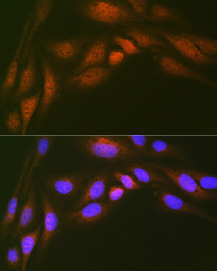 Ube2N/Ubc13 Rabbit monoclonal antibody