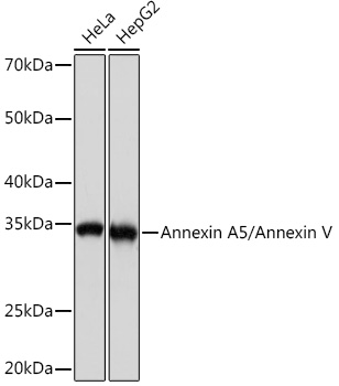 Annexin A5/Annexin V Rabbit monoclonal antibody