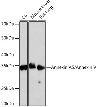 Annexin A5/Annexin V Rabbit monoclonal antibody