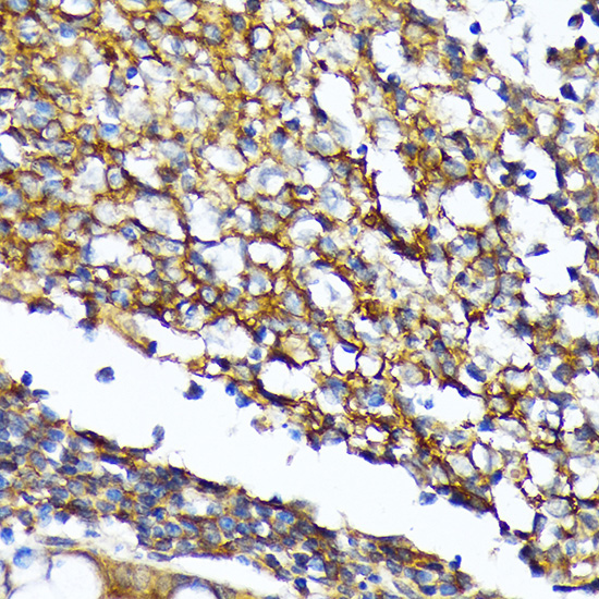 CD82 Rabbit monoclonal antibody