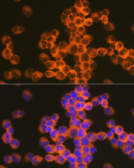 CD82 Rabbit monoclonal antibody