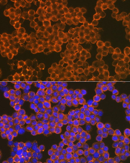 CD82 Rabbit monoclonal antibody