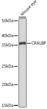 CRALBP Rabbit monoclonal antibody
