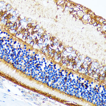 CRALBP Rabbit monoclonal antibody