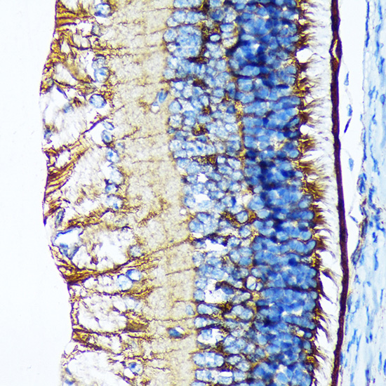 CRALBP Rabbit monoclonal antibody