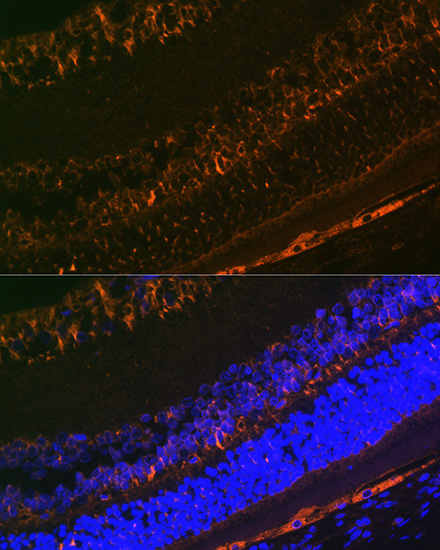 CRALBP Rabbit monoclonal antibody