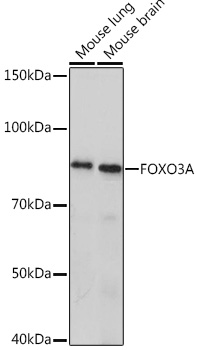 FOXO3A Rabbit monoclonal antibody