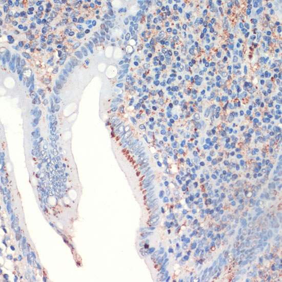 Somatostatin (SST) Rabbit polyclonal antibody