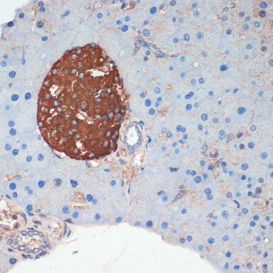 Somatostatin (SST) Rabbit polyclonal antibody