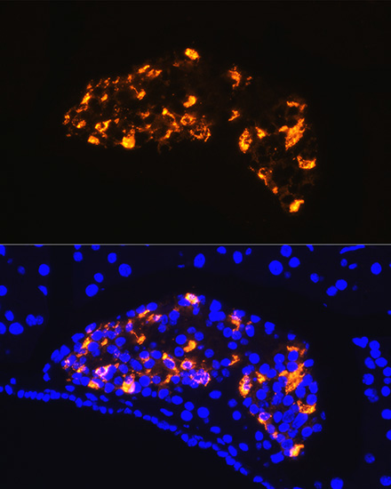 Somatostatin (SST) Rabbit polyclonal antibody
