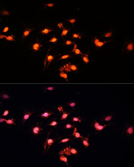 GTF3C4 Rabbit polyclonal antibody