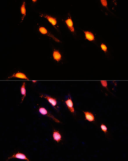 GTF3C4 Rabbit polyclonal antibody