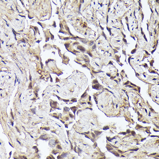 METTL4 Rabbit polyclonal antibody