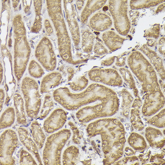 METTL4 Rabbit polyclonal antibody