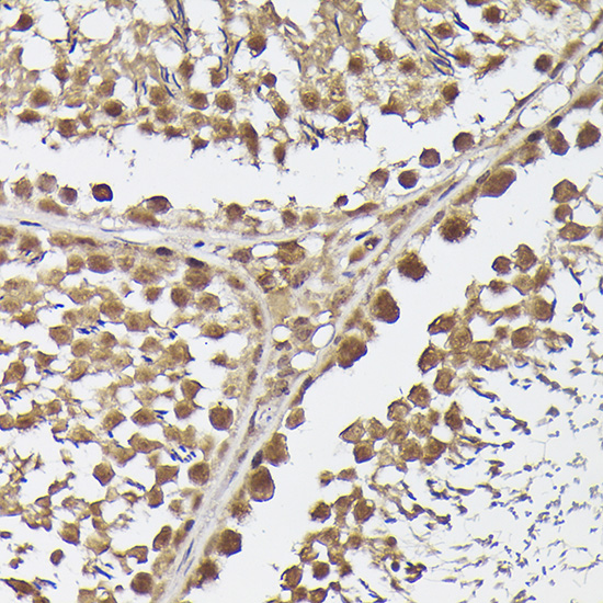 METTL4 Rabbit polyclonal antibody