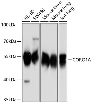 CORO1A Rabbit polyclonal antibody