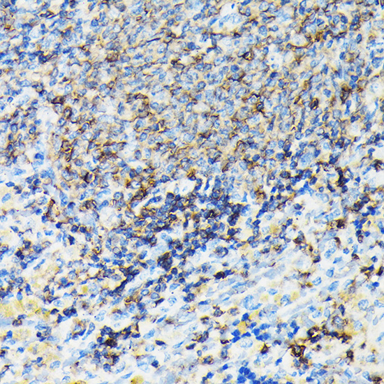 CORO1A Rabbit polyclonal antibody