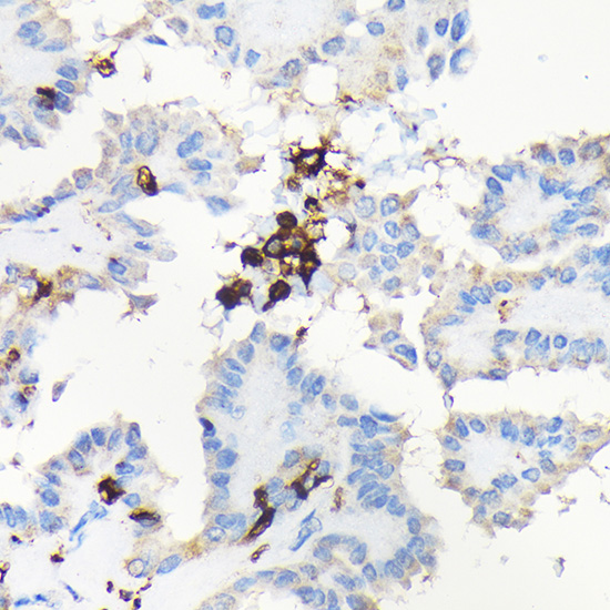 CORO1A Rabbit polyclonal antibody