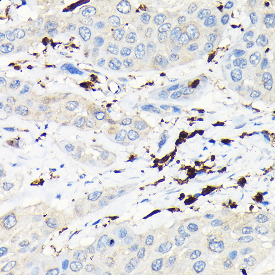 CORO1A Rabbit polyclonal antibody