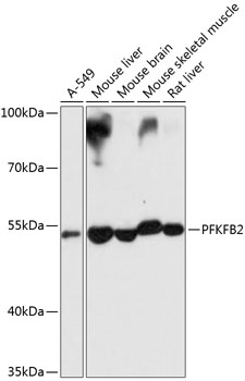 PFKFB2 Rabbit polyclonal antibody