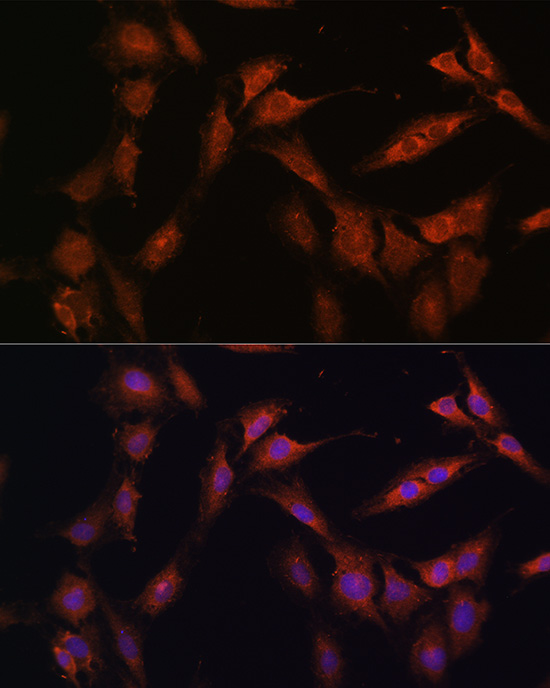 PFKFB2 Rabbit polyclonal antibody