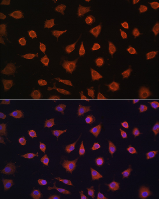 PFKFB2 Rabbit polyclonal antibody