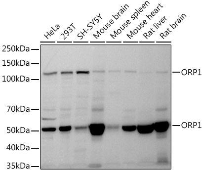 ORP1 Rabbit monoclonal antibody