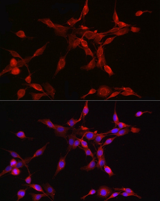 ORP1 Rabbit monoclonal antibody