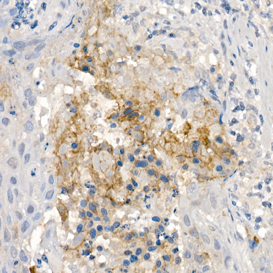 CNTN4 Rabbit monoclonal antibody