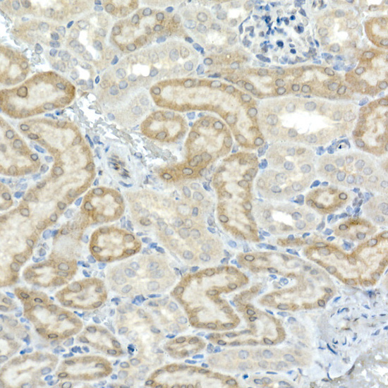 CNTN4 Rabbit monoclonal antibody