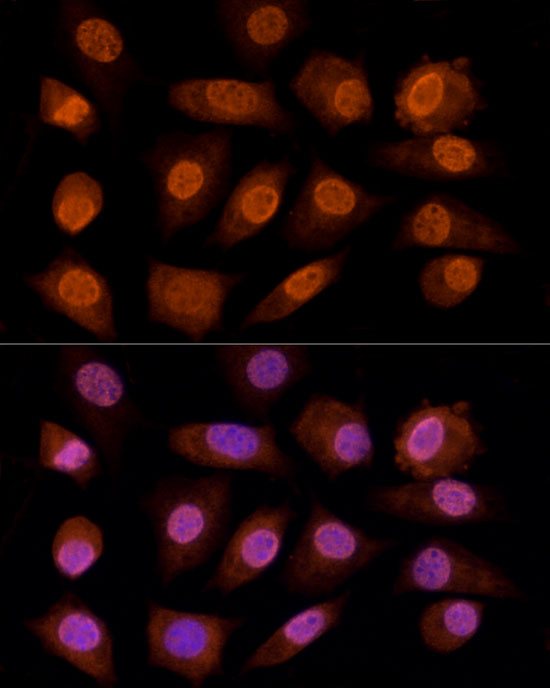 CRYGC Rabbit polyclonal antibody