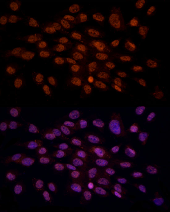 CRYGC Rabbit polyclonal antibody